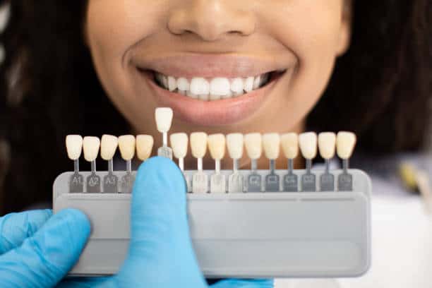 Laser Teeth Whitening: Exploring the Longevity of Your Brighter Smile Peterborough