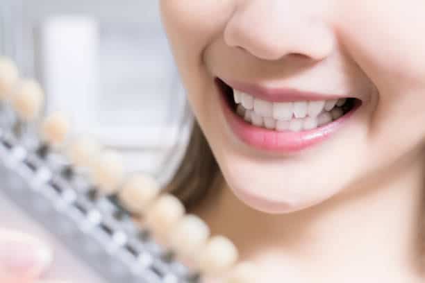 Teeth Whitening Kings Norton Peterborough