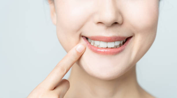 Comparing the Pain Factor: Laser Teeth Whitening vs. Zoom Teeth Whitening Peterborough