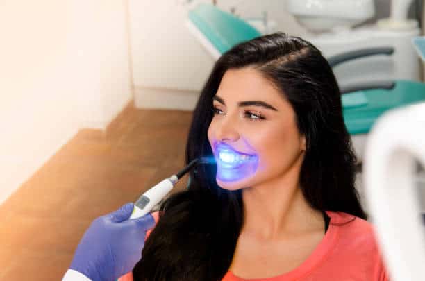 Top Teeth Whitening Systems for a Brighter Smile Peterborough