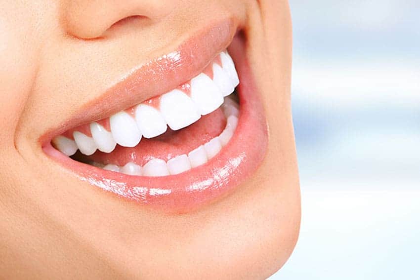 Teeth Whitening Abingdon Peterborough