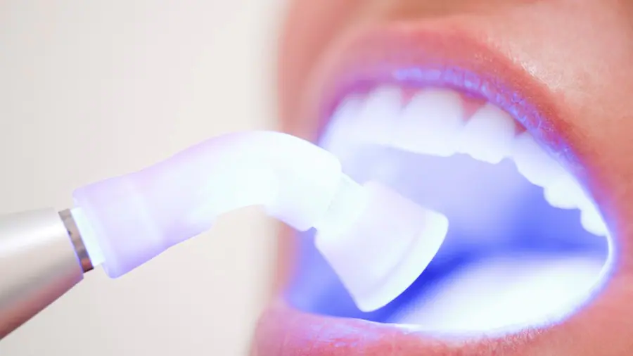 Teeth Whitening Aylesbury Peterborough